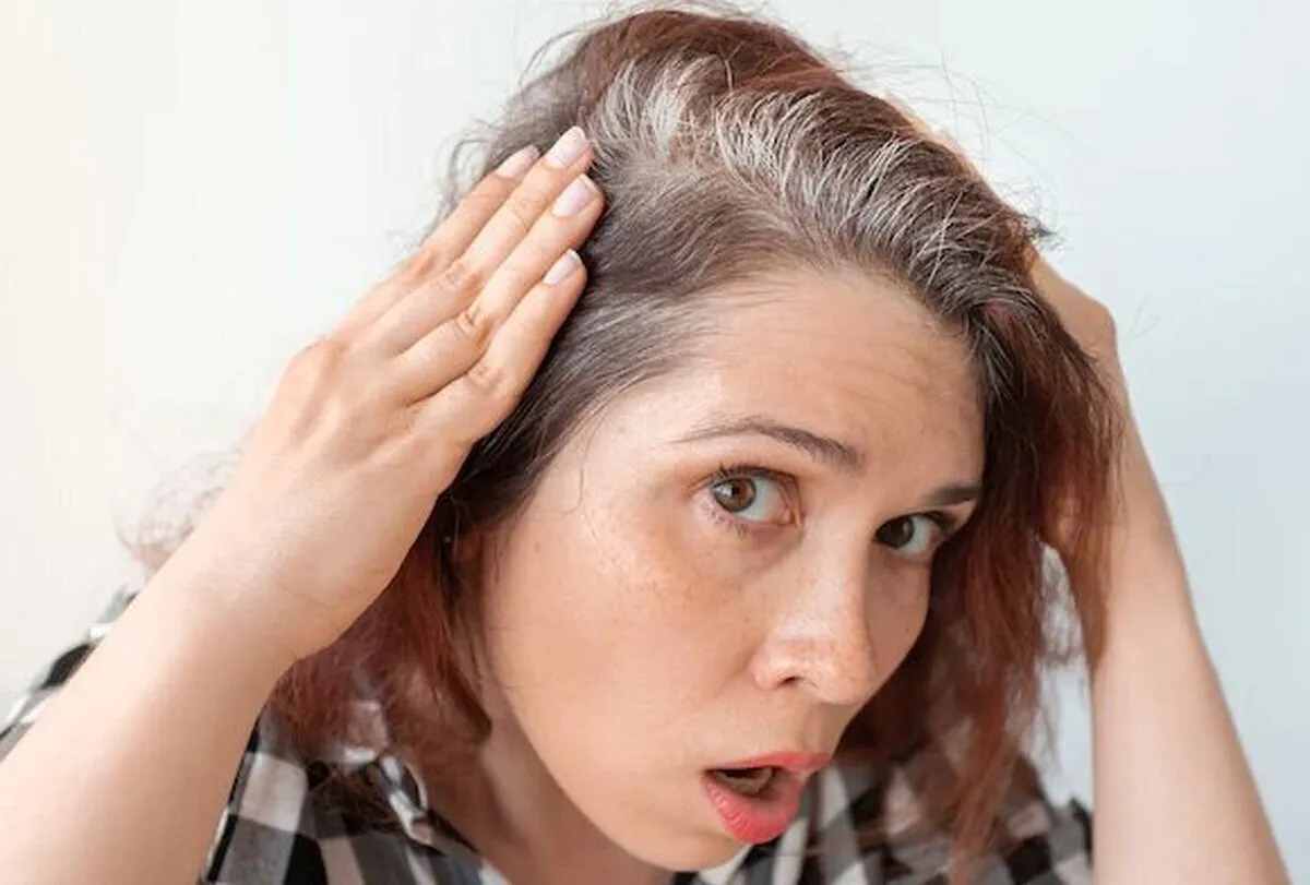 علت سفیدشدن موها در سنین پائین مشخص شد