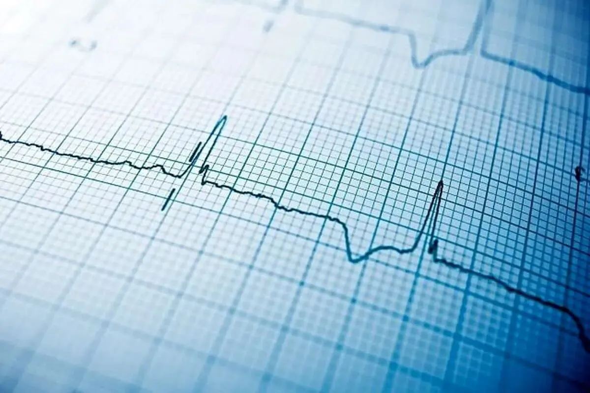 میانگین سنی فوتی‌ها در کشور چقدر است؟