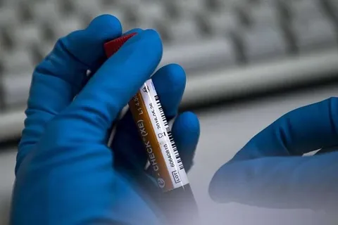 ۳ دوپینگ جدید در کشتی ایران